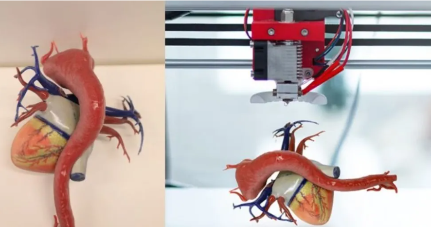 外科醫(yī)生利用3D 打印心臟模型治療心血管異常 image