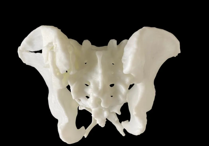 科學家3D打印出珊瑚仿生骨移植替代品，僅需2-4周即可長出新骨 image